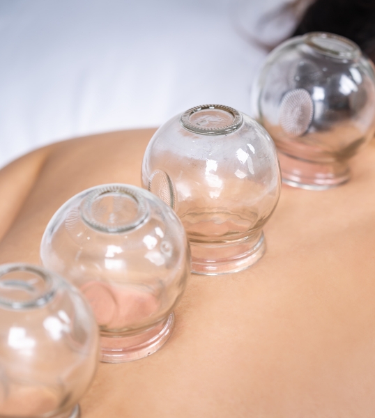 Cupping Treatment in Spokane