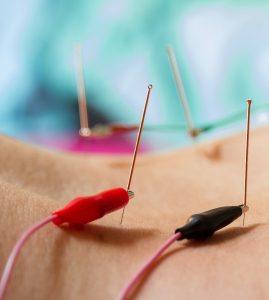 Electroacupuncture Treatment in Spokane, WA